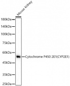Cytochrome P450 2E1 (CYP2E1) Rabbit mAb (A23030)