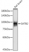 SATB2 Rabbit mAb (A19837)