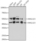 JNK1/2/3 Rabbit mAb (A4867)
