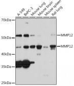 MMP12 Rabbit mAb (A3713)
