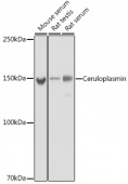 Ceruloplasmin Rabbit mAb (A20229)