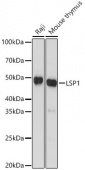 LSP1 Rabbit mAb (A3355)