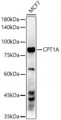 CPT1A Rabbit mAb (A20746)