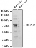 MS4A14 Rabbit mAb (A20965)