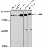RhoGAP Rabbit mAb (A2330)