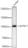 SLFN11 Rabbit mAb (A20809)