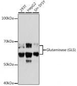 Glutaminase (GLS) Rabbit mAb (A11043)