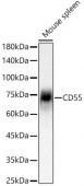 CD55 Rabbit mAb (A23694)