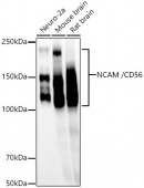 NCAM /CD56 Rabbit mAb (A23300)