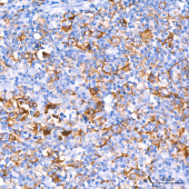 CD30 Rabbit mAb (A21230)