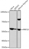 PRP19 Rabbit mAb (A9660)
