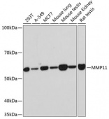 MMP11 Rabbit mAb (A11088)