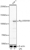 Rig-I/DDX58 Rabbit mAb (A22478)