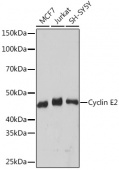 Cyclin E2 Rabbit mAb (A9305)