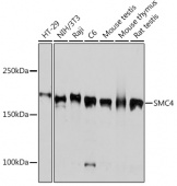 SMC4 Rabbit mAb (A3559)