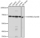 KHDRBS1/Sam68 Rabbit mAb (A3886)