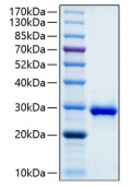 Recombinant Human IGFBP-1 Protein (RP00237)