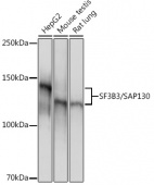 SF3B3/SAP130 Rabbit mAb (A9624)