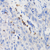 CD11b/ITGAM Rabbit mAb (A19010)