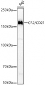 CR2/CD21 Rabbit mAb (A22401)
