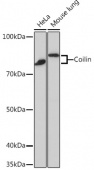 Coilin Rabbit mAb (A3483)