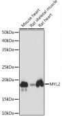 MYL2 Rabbit mAb (A8742)