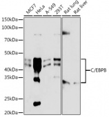 C/EBPB Rabbit mAb (A19538)