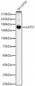 LATS1 Rabbit mAb (A22287)