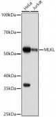 MLKL Rabbit mAb (A19685)