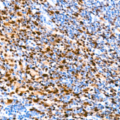 MUM1 Rabbit mAb (A23227)