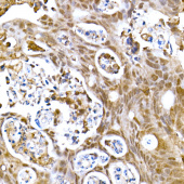SOCS1 Rabbit mAb (A20838)