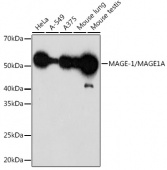 MAGE-1/MAGE1A Rabbit mAb (A0723)