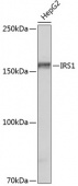 IRS1 Rabbit mAb (A19074)