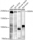 DENN Rabbit mAb (A20898)