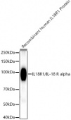 IL18R1/IL-18 R alpha Rabbit mAb (A21208)
