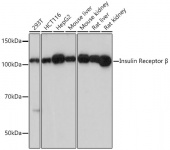 Insulin Receptor Rabbit mAb (A19067)
