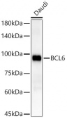 BCL6 Rabbit mAb (A22610)