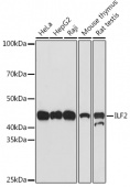 ILF2 Rabbit mAb (A9530)
