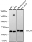 INTS11 Rabbit mAb (A22698)