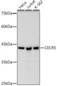 CECR5 Rabbit mAb (A20974)