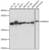 PSMA3 Rabbit mAb (A5094)