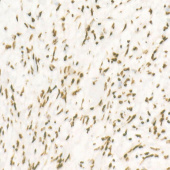 CDK12 Rabbit mAb (A22474)
