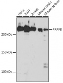 PRPF8 Rabbit mAb (A4575)