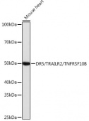 DR5/TRAILR2/TNFRSF10B Rabbit mAb (A19043)