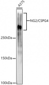 NG2/CSPG4 Rabbit mAb (A21095)