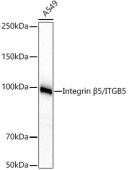Integrin β5/ITGB5 Rabbit mAb (A23428)