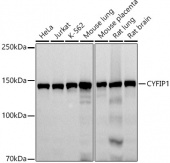 CYFIP1 Rabbit mAb (A20924)