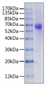 Recombinant Human CX3CL1/Fractalkine Protein (RP00344)