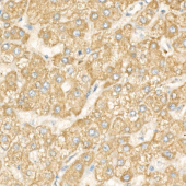 DGAT1 Rabbit mAb (A23078)