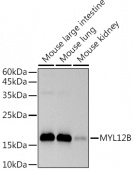 MYL12B Rabbit mAb (A9387)
